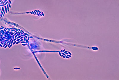  Fusarium verticilliodes فطر