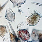 Phytoplankton